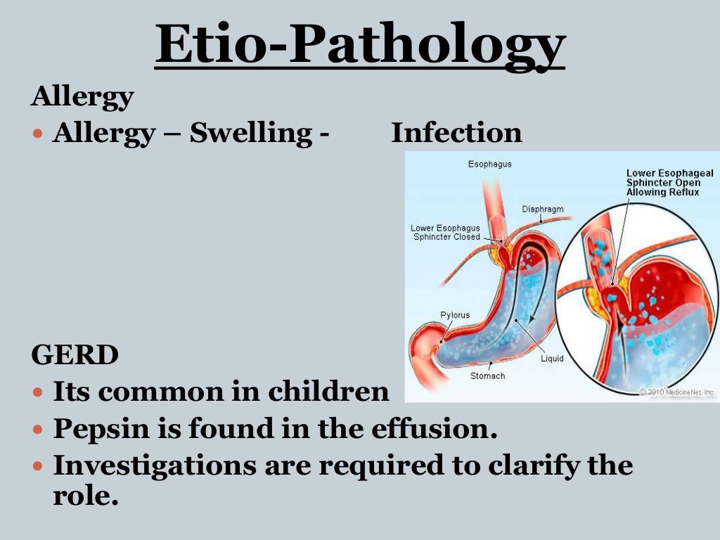 Otitis Media with Effusion