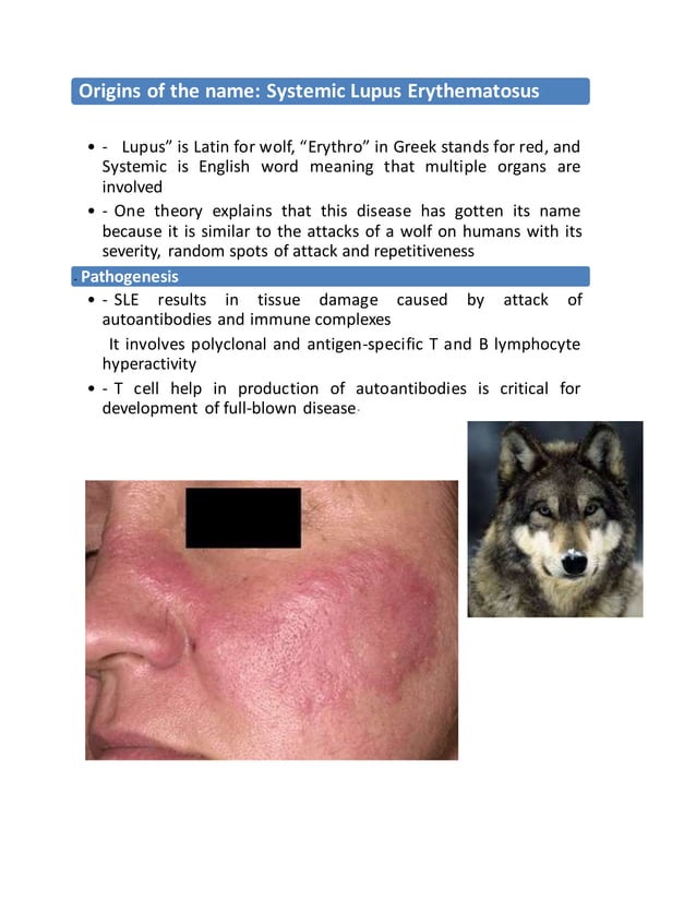 dental Management of Systemic Lupus Erythematous & Scleroderma