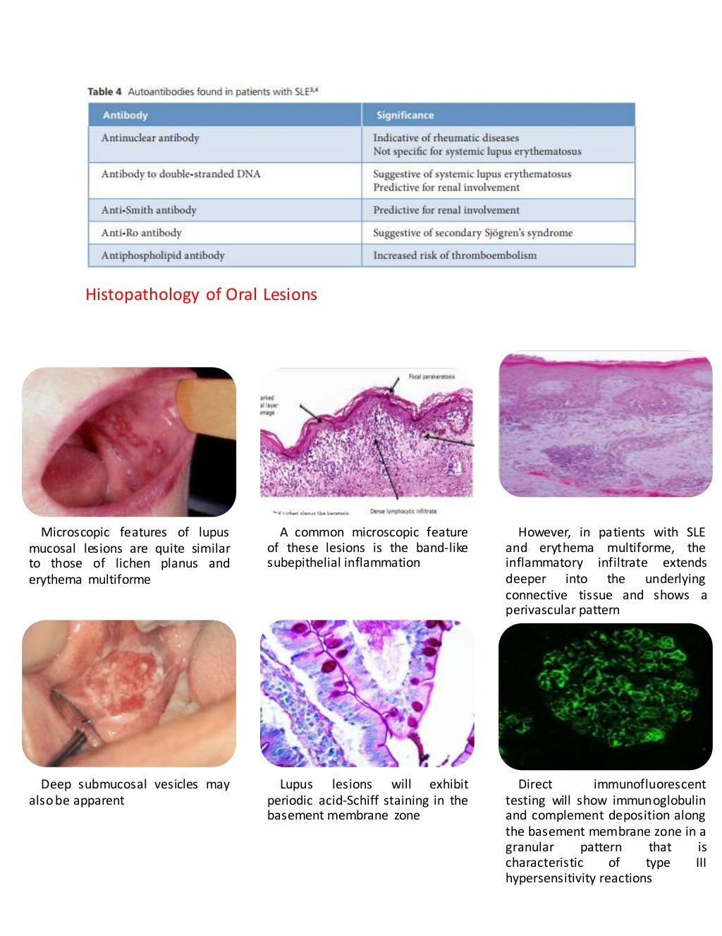 dental Management of Systemic Lupus Erythematous & Scleroderma