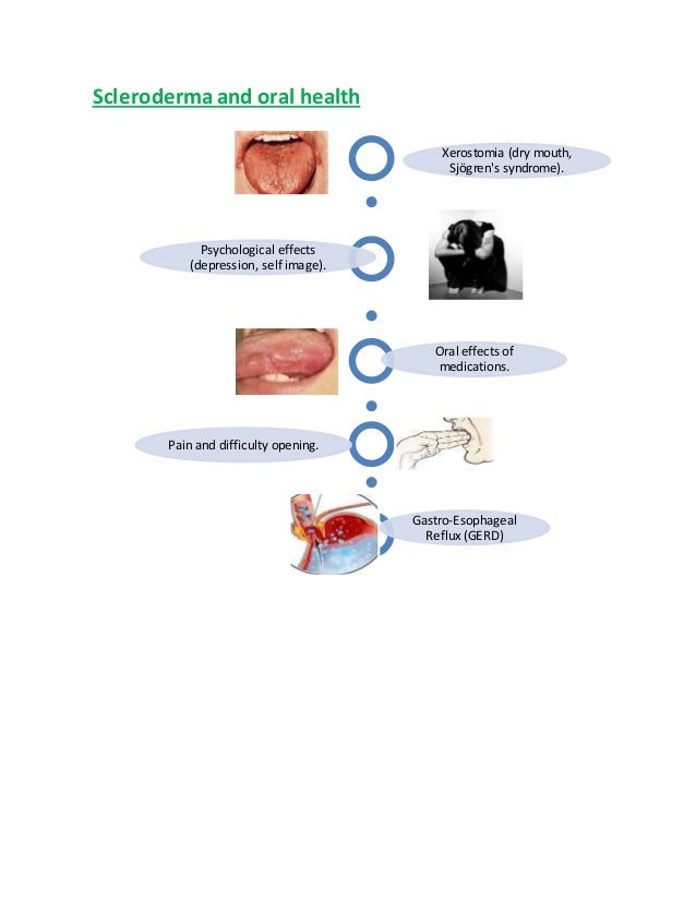 dental Management of Systemic Lupus Erythematous & Scleroderma
