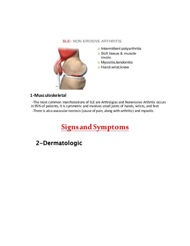 dental Management of Systemic Lupus Erythematous & Scleroderma