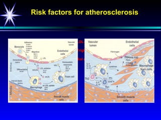 Risk factors for atherosclerosis


                         LDL-cholesterol
 Elevated blood lipids                     Hypertension
                         Triglycerides

                 Endothelial dysfunction




                             Inflammation
 