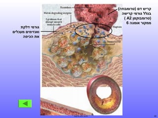 ‫קריש דם )טרומבוזה(‬
‫בגלל גורמי קרישה‬
‫)טרומבוקסן 2‪( A‬‬
‫ממקור אומגה 6‬

‫56‬

‫גורמי דלקת‬
‫ואנזימים מעכלים‬
‫את הכיפה‬

‫לחיות ללא תרופות‬

 