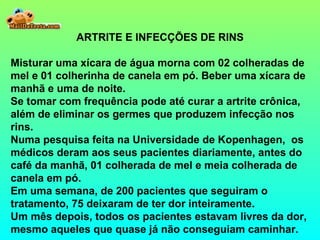ARTRITE E INFECÇÕES DE RINS
Misturar uma xícara de água morna com 02 colheradas de
mel e 01 colherinha de canela em pó. Beber uma xícara de
manhã e uma de noite.
Se tomar com frequência pode até curar a artrite crônica,
além de eliminar os germes que produzem infecção nos
rins.
Numa pesquisa feita na Universidade de Kopenhagen, os
médicos deram aos seus pacientes diariamente, antes do
café da manhã, 01 colherada de mel e meia colherada de
canela em pó.
Em uma semana, de 200 pacientes que seguiram o
tratamento, 75 deixaram de ter dor inteiramente.
Um mês depois, todos os pacientes estavam livres da dor,
mesmo aqueles que quase já não conseguiam caminhar.
 