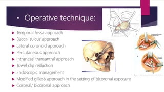 • Operative technique:
 Temporal fossa approach
 Buccal sulcus approach
 Lateral coronoid approach
 Percutaneous approach
 Intranasal transantral approach
 Towel clip reduction
 Endoscopic management
 Modified gilles’s approach in the setting of bicoronal exposure
 Coronal/ bicoronal approach
 