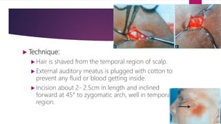  Technique:
 Hair is shaved from the temporal region of scalp.
 External auditory meatus is plugged with cotton to
prevent any fluid or blood getting inside.
 Incision about 2- 2.5cm in length and inclined
forward at 45° to zygomatic arch, well in temporal
region.
 