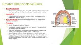 Greater Palatine Nerve Block
 Areas Anesthetized
 The posterior portion of the hard palate and its overlying soft tissues,
anteriorly as far as the first premolar and medially to the midline
 Landmarks:
 greater palatine foramen and junction of the maxillary alveolar
process and palatine bone.
 Area of insertion: soft tissue slightly anterior to the greater
palatine foramen.
 Procedure
 Locate the greater palatine foramen
 Prepare the tissue at the injection site, just 1 to 2 mm anterior to
the greater palatine foramen
 Direct the syringe into the mouth from the opposite side with the
needle approaching the injection site at a right angle
 Place the bevel (not the point) of the needle gently against the
blanched (ischemic) soft tissue at the injection site. It must be well
stabilized to prevent accidental penetration of the tissues. h. With
the bevel lying against the tissue: Apply enough pressure to bow the
needle slightly
 