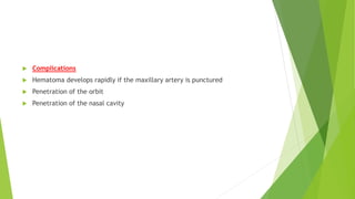  Complications
 Hematoma develops rapidly if the maxillary artery is punctured
 Penetration of the orbit
 Penetration of the nasal cavity
 