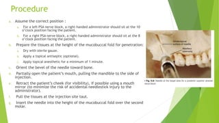 Procedure
a. Assume the correct position :
a. For a left PSA nerve block, a right-handed administrator should sit at the 10
o’clock position facing the patient.
b. For a right PSA nerve block, a right-handed administrator should sit at the 8
o’clock position facing the patient.
b. Prepare the tissues at the height of the mucobuccal fold for penetration:
a. Dry with sterile gauze.
b. Apply a topical antiseptic (optional).
c. Apply topical anesthetic for a minimum of 1 minute.
c. Orient the bevel of the needle toward bone.
d. Partially open the patient’s mouth, pulling the mandible to the side of
injection.
e. Retract the patient’s cheek (for visibility), if possible using a mouth
mirror (to minimize the risk of accidental needlestick injury to the
administrator).
f. Pull the tissues at the injection site taut.
g. Insert the needle into the height of the mucobuccal fold over the second
molar.
 
