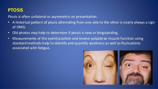 Ppt Eyes In Finals Powerpoint Presentation Free Download Id
