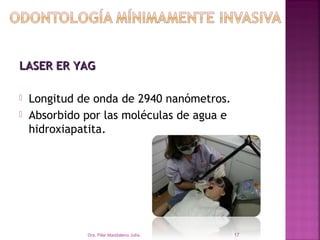 LASER ER YAG

   Longitud de onda de 2940 nanómetros.
   Absorbido por las moléculas de agua e
    hidroxiapatita.




              Dra. Pilar Maddaleno Julía.   17
 