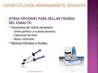    OTRAS OPCIONES PARA SELLAR FISURAS
    DEL ESMALTE:
     Cementos    de vidrio ionómero
        Unión química a la pieza dentaria.
        Liberación de flúor.
        Menor retención.
     Resinas   hibridas o fluidas.




                   Dra. Pilar Maddaleno Julía.   32
 