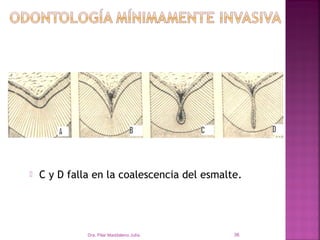    C y D falla en la coalescencia del esmalte.




              Dra. Pilar Maddaleno Julía.    36
 