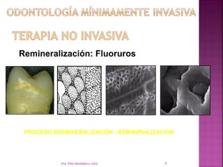 Remineralización: Fluoruros




 PROCESO DESMINERALIZACIÓN - REMINERALIZACIÓN




           Dra. Pilar Maddaleno Julía.    5
 