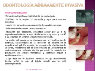 Técnica de utilización
Toma   de radiografía periapical de la pieza afectada.
Profilaxis   de la región con escobilla y agua para remover
dentritus.
Lavado   con spray de agua o con mota de algodón con agua.
Aislamiento   relativo del campo operatorio.
Aplicación del papacarie, dejándolo actuar por 30 a 40
segundos en lesiones cariosas rápidamente progresivas y por 40
a 60 segundos en lesiones lentamente progresivas.
La acción del producto es observada por la visualización de
burbujas, característica de la liberación de oxigeno en la
superficie del gel. En seguida, se procede a la eliminación de
la caries, realizándola con el lado contrario de la cuchareta de
caries o con una cuchareta sin filo, por medio de movimientos
pendulares en sentido mesiodistal y vestíbulo lingual o
vestibulopalatino..
El gel debe ser re aplicado mientras se siga manteniendo
turbio, señal de que el tejido cariado aún se está
descomponiendo.

                        Dra. Pilar Maddaleno Julía.                51
 