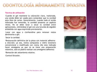 Técnica de utilización
Cuando   el gel mantiene la coloración clara, inalterada,
una sonda debe ser usada para comprobar que la cavidad
esta libre de caries. Generalmente, cuando todo el tejido
infectado fue removido, la cavidad presenta un aspecto
vítreo. No se debe lavar o secar la cavidad entre
aplicaciones, retirándose el gel con una torunda de algodón
embebida con agua exprimida previamente.
Lavar con agua o clorhexidina para remover restos
dentinarios o gel.
Secar   la cavidad.
Restauración  definitiva de la pieza con material adhesivo
a elección; ya sea, resina compuesta o vidrio ionomero
convencional o modificado con resina (No esta indicado
hacer amalgama ya que no se tiene una preparación
retentiva, solo se podría realizar una amalgama adhesiva)
Remoción    del aislamiento relativo.
Control   Oclusión.




                           Dra. Pilar Maddaleno Julía.        52
 