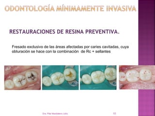 RESTAURACIONES DE RESINA PREVENTIVA.

Fresado exclusivo de las áreas afectadas por caries cavitadas, cuya
obturación se hace con la combinación de Rc + sellantes




                 Dra. Pilar Maddaleno Julía.              53
 