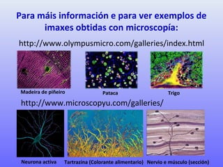 Para máis información e para ver exemplos de
imaxes obtidas con microscopía:
http://www.olympusmicro.com/galleries/index.html
http://www.microscopyu.com/galleries/
Madeira de piñeiro Pataca Trigo
Neurona activa Tartrazina (Colorante alimentario) Nervio e músculo (sección)
 