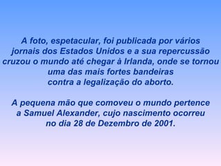 A foto, espetacular, foi publicada por vários jornais dos Estados Unidos e a sua repercussão cruzou o mundo até chegar à Irlanda, onde se tornou uma das mais fortes bandeiras contra a legalização do aborto. A pequena mão que comoveu o mundo pertence a Samuel Alexander, cujo nascimento ocorreu no dia 28 de Dezembro de 2001. 