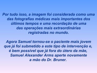 Por tudo isso, a imagem foi considerada como uma das fotografias médicas mais importantes dos últimos tempos e uma recordação de uma das operações mais extraordinárias registradas no mundo. Agora Samuel tornou-se o paciente mais jovem que já foi submetido a este tipo de intervenção e,  é bem possível que já fora do útero da mãe,  Samuel Alexander Arms aperte novamente a mão do Dr. Bruner.  