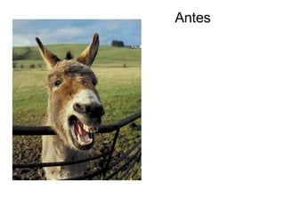 Antes 