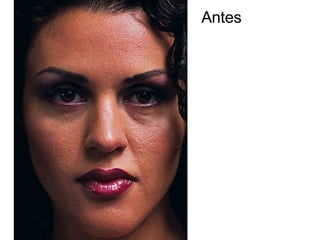 Antes 