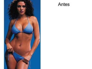 Antes 