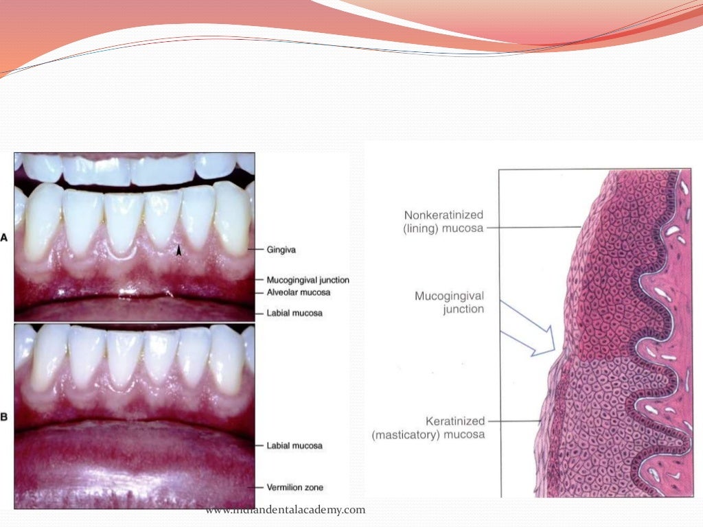 oral mucous membranes2 /certified fixed orthodontic courses by India…