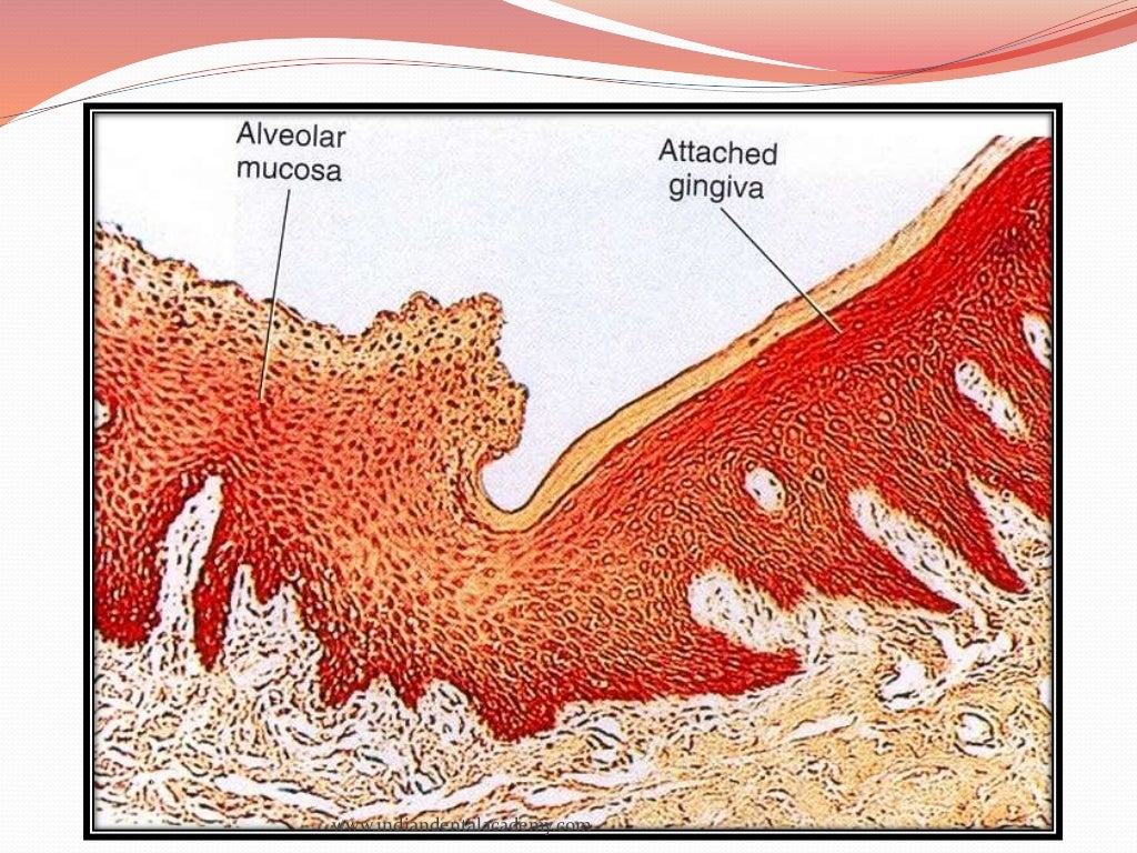 oral mucous membranes2 /certified fixed orthodontic courses by India…