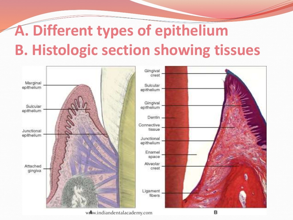 oral mucous membranes2 /certified fixed orthodontic courses by India…
