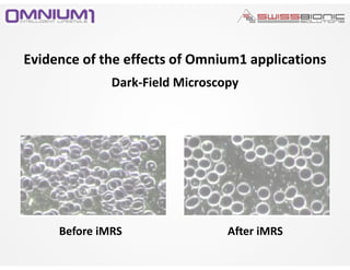 Evidence of the effects of Omnium1 applications
Before iMRS After iMRS
Dark-Field Microscopy
 