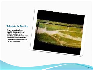 Tabuleta de Marfim Possui gravada na faixa superior do seu quadro um alfabeto arcaico muito completo, destinado a servir de modelo de escrita incipiente que se exercitava escrevendo na cera da tabuleta. 