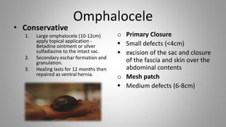 OMPHALOCELE VS GASTROSCHISIS.pdf