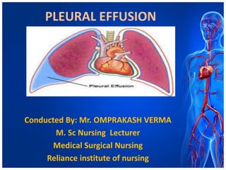 PLEURAL EFFUSION
Conducted By: Mr. OMPRAKASH VERMA
M. Sc Nursing Lecturer
Medical Surgical Nursing
Reliance institute of nursing
 