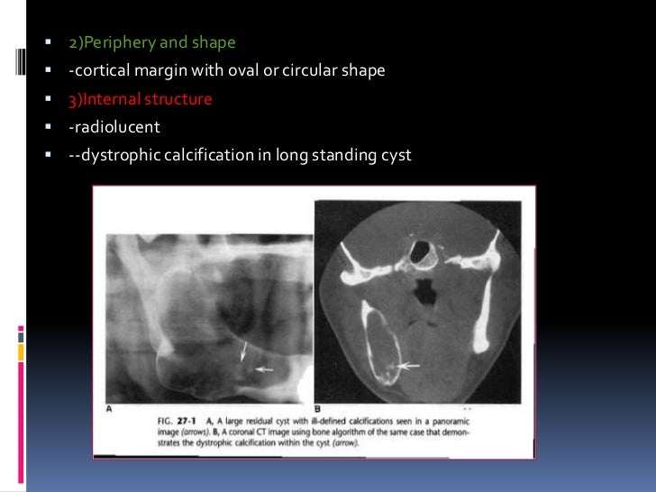 OROFACIAL CYST