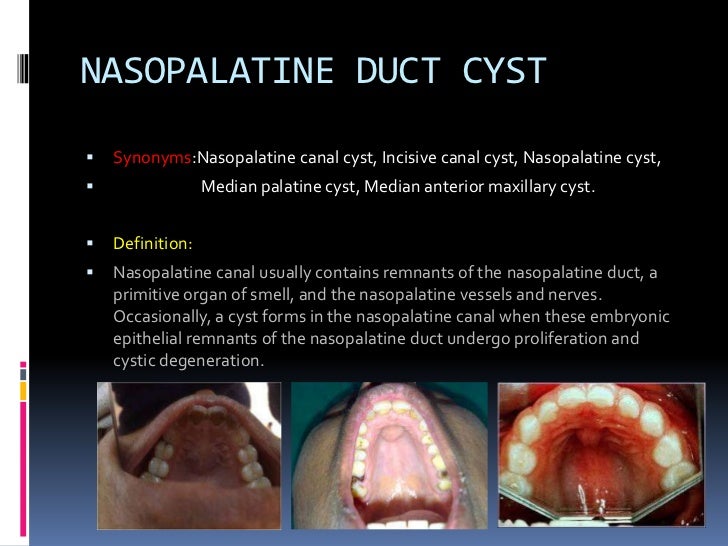 OROFACIAL CYST