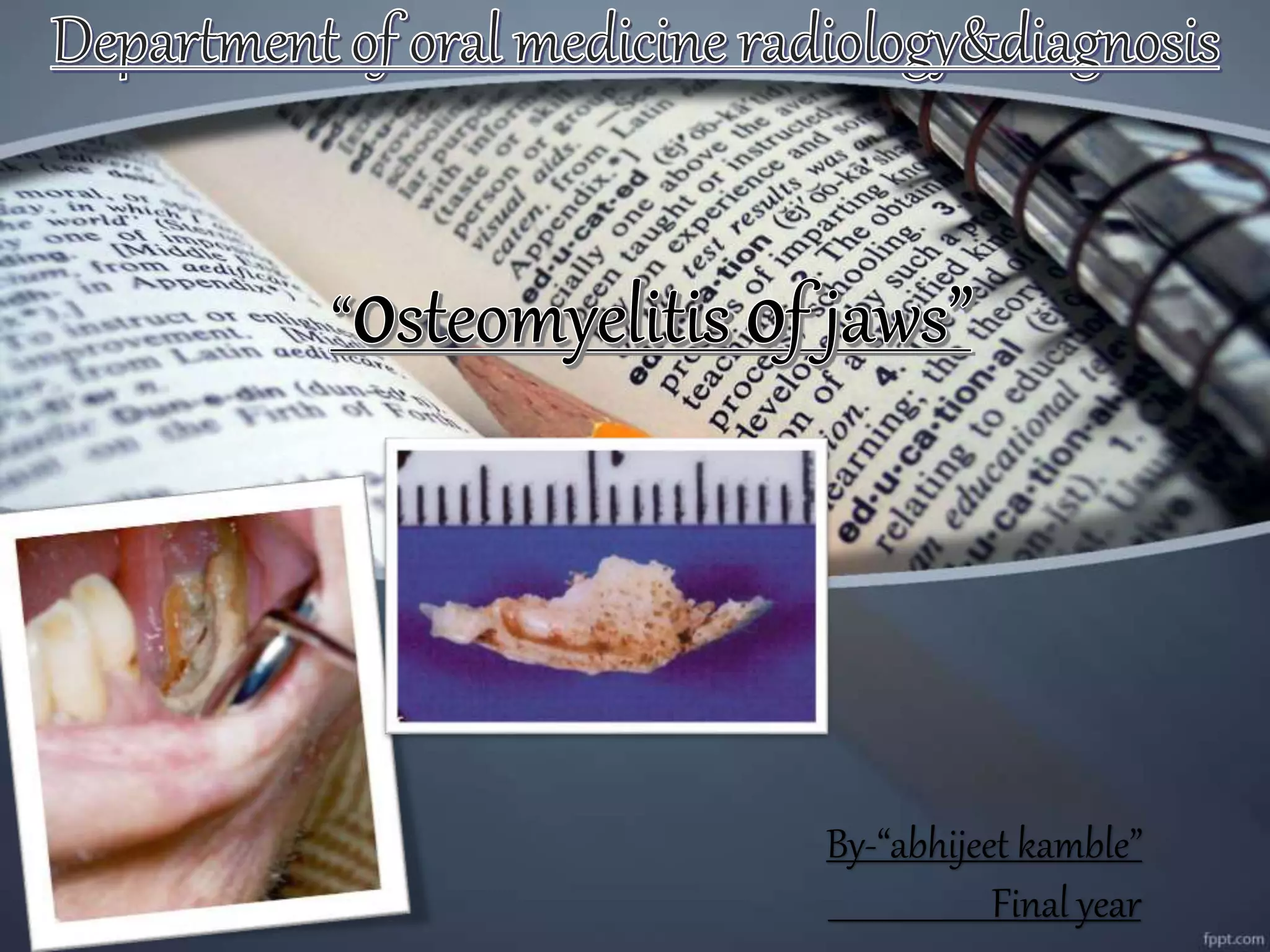 Osteomyelitis of jawdepartment of oral medicine and radiology PPT