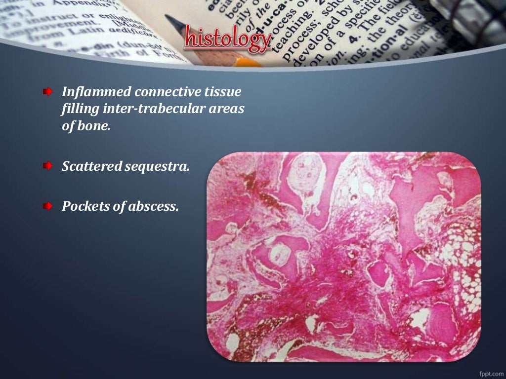 Osteomyelitis of jawdepartment of oral medicine and radiology