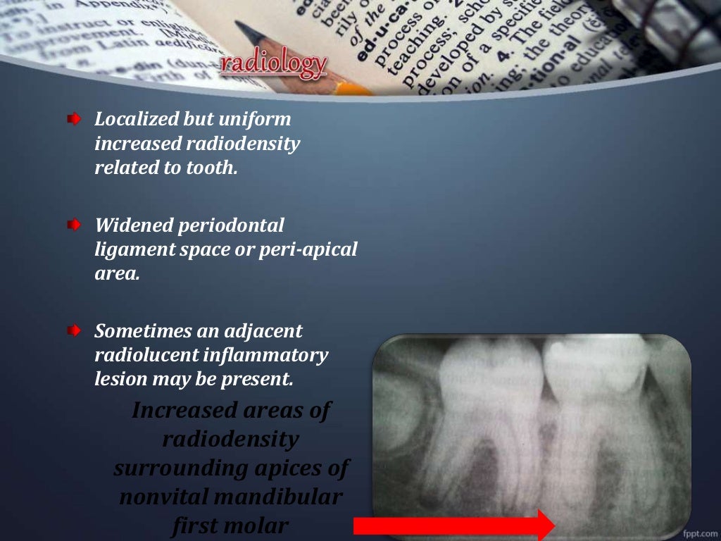 Osteomyelitis of jawdepartment of oral medicine and radiology