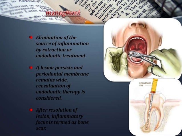 osteomyelitis radiology extraction
