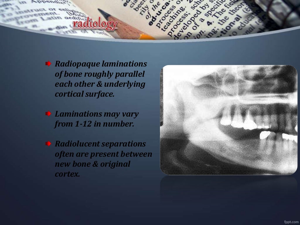 Osteomyelitis of jawdepartment of oral medicine and radiology
