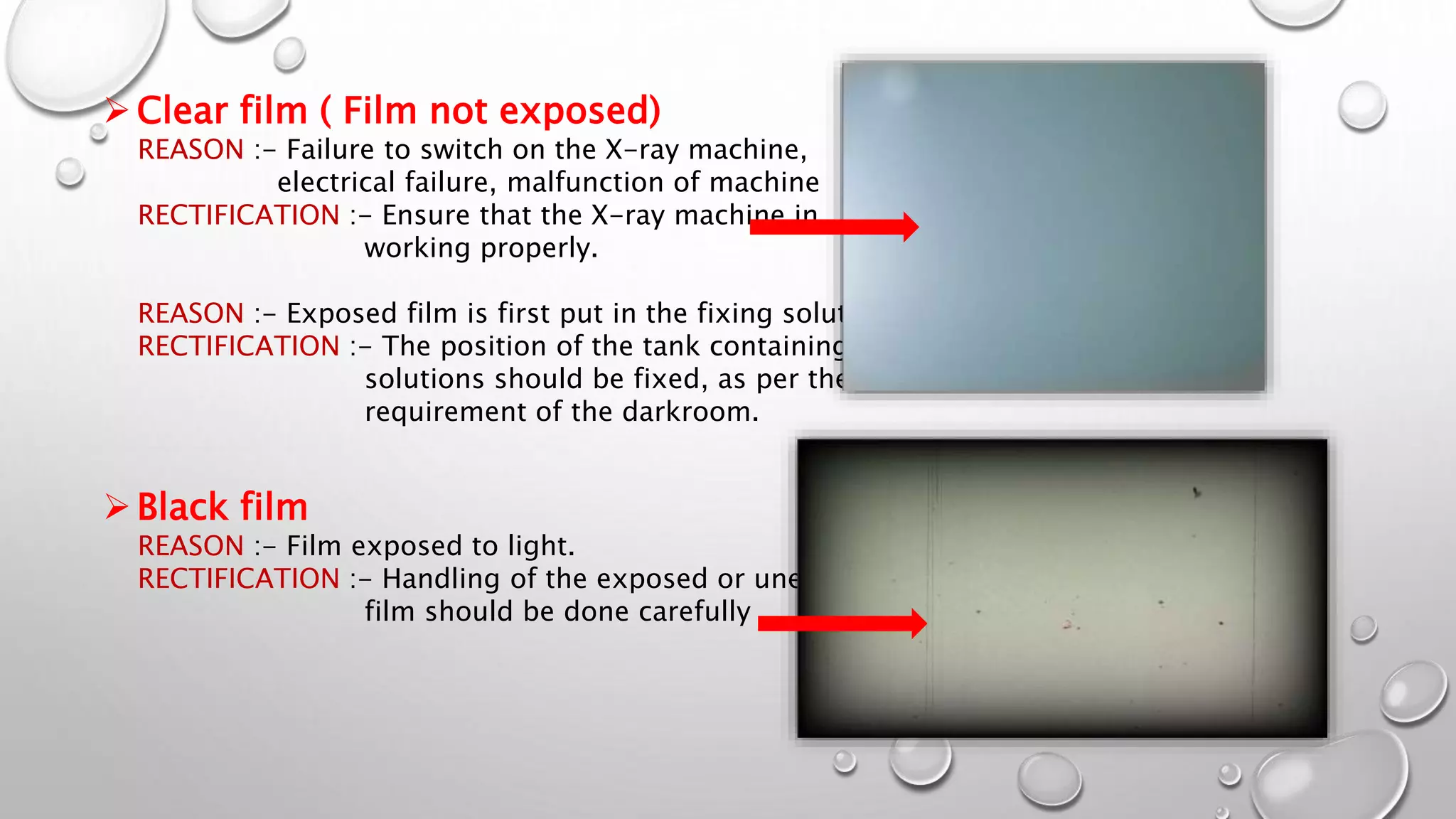 Faulty Radiographs | PPTX