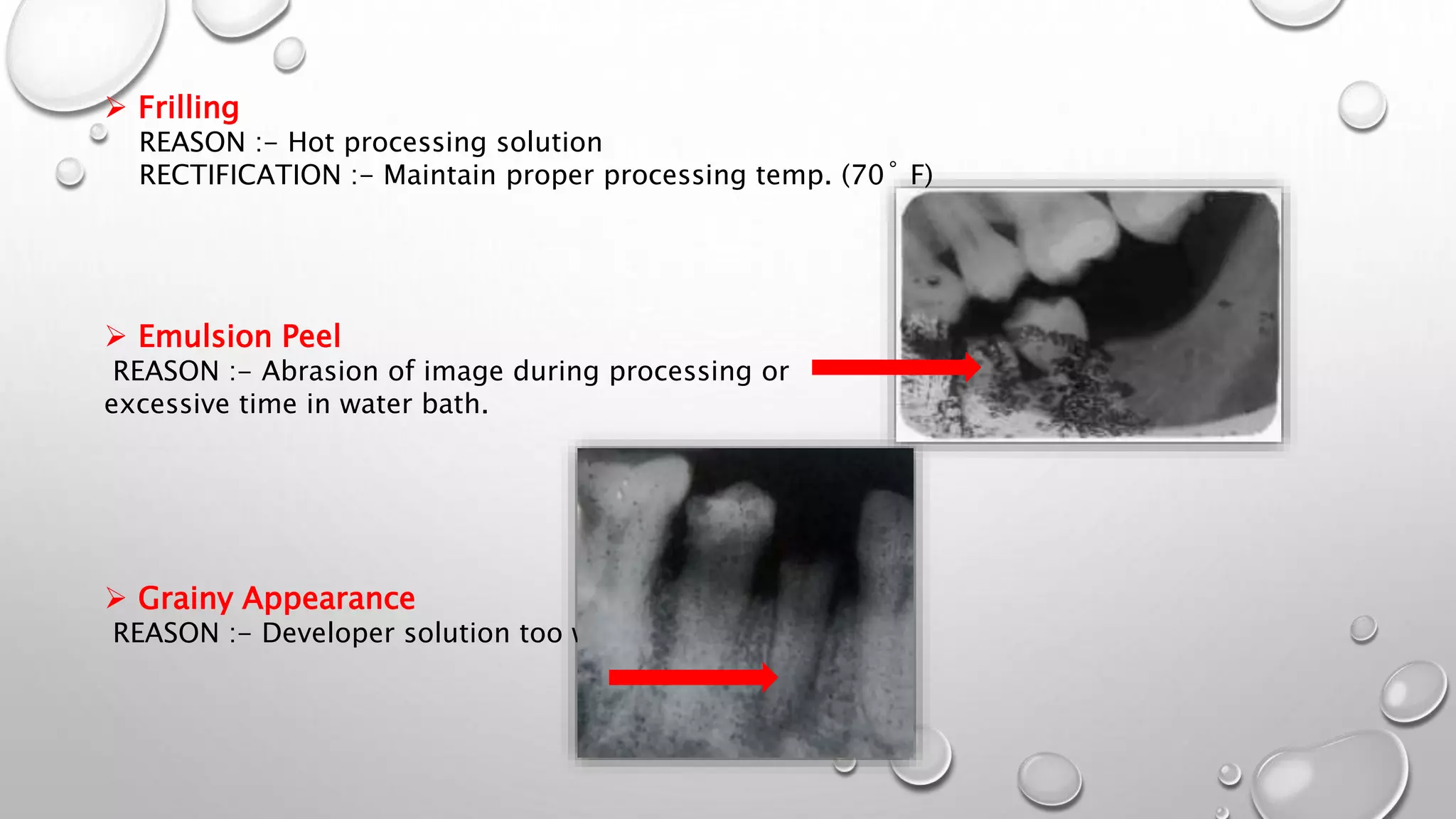 Faulty Radiographs | PPTX