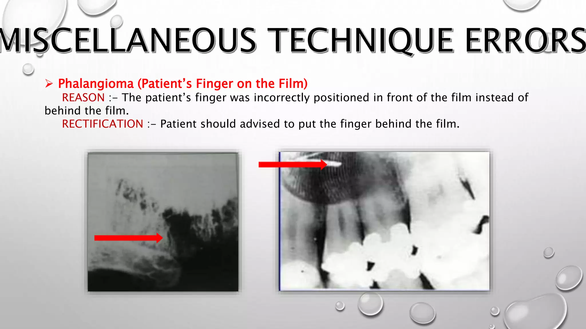 Faulty Radiographs | PPTX