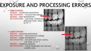  High Contrast
REASON :- Insufficient penetration
RECTIFICATION :- Increase kilo voltage.
REASON :- Over development
RECTIFICATION :- Use temp. method with a
darkroom timer, lower temp.
to 70˚ F
 Light Contrast
REASON :- Excessive penetration
RECTIFICATION :- Decreased kilo voltage
REASON :- Under development
RECTIFICATION :- Set darkroom timer correct,
rise temp. to 70˚ F
REASON :- Scattered radiation
RECTIFICATION :- Check diaphragm size and use
suitable cone.
 