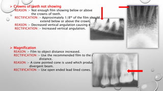  Crowns of teeth not showing
REASON :- Not enough film showing below or above
the crowns of teeth.
RECTIFICATION :- Approximately 1/8th of the film should
extend below or above the crown.
REASON :- Decreased vertical angulation causing elongation.
RECTIFICATION :- Increased vertical angulation.
 Magnification
REASON :- Film to object distance increased.
RECTIFICATION :- Use the recommended film to the object
distance.
REASON :- A cone pointed cone is used which produces a
divergent beam.
RECTIFICATION :- Use open ended lead lined cones.
 