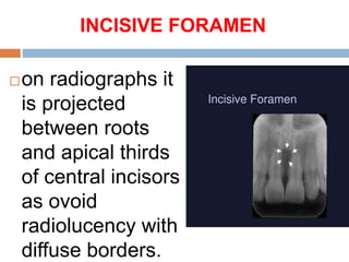 INCISIVE FORAMEN
on radiographs it
is projected
between roots
and apical thirds
of central incisors
as ovoid
radiolucency with
diffuse borders.
 