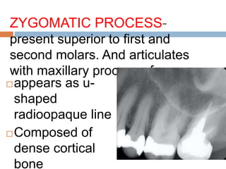ZYGOMATIC PROCESS-
present superior to first and
second molars. And articulates
with maxillary process of zygoma.
appears as u-
shaped
radioopaque line
Composed of
dense cortical
bone
 