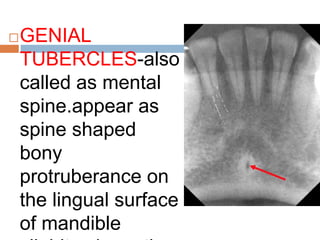 GENIAL
TUBERCLES-also
called as mental
spine.appear as
spine shaped
bony
protruberance on
the lingual surface
of mandible
 