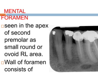 MENTAL
FORAMEN
seen in the apex
of second
premolar as
small round or
ovoid RL area.
Wall of foramen
consists of
 